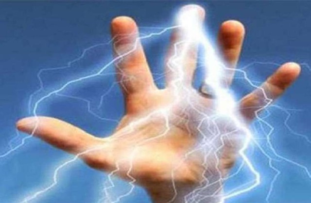 विद्युत प्राधिकरणको लापरबाही : करेन्ट लागेर बालिकाको हात गुम्यो